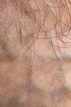 Male Body Hair Skin Texture Close-up 