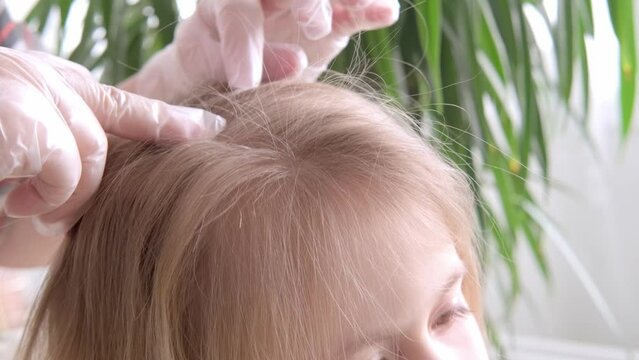 Close-up child's head with female hands searching for lice and nits in hair, doctor's fingers in gloves, combing with orange comb for removal, Pediculosis infestation, Medical Examination