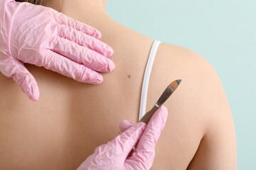 Surgeon with scalpel and moles on woman's body against green background, back view