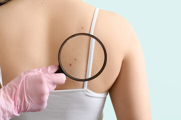Dermatologist with magnifier examining moles on woman's body against green background, back view