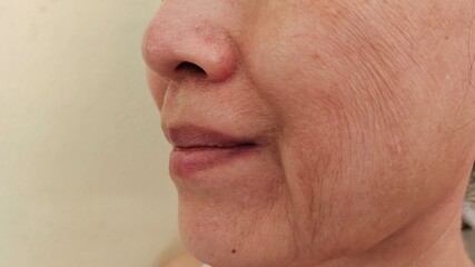 close up the flabbiness and wrinkle beside the mouth, dullness and loose, Flabby skin and creases on the face of the woman health care and beauty concept.