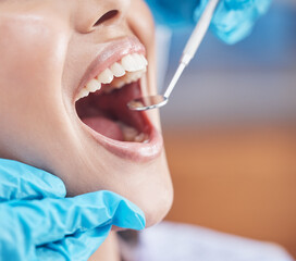 Mirror, woman and mouth open for hygiene at dentist of teeth checkup, cleaning or whitening treatment. Dental, patient and medical examination of gingivitis, orthodontist or veneer results at clinic