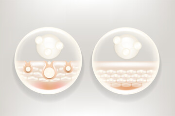 Hyaluronic acid and Niacinamide before and after hair and skin solutions ad, white collagen serum drops into skin cell with cosmetic advertising background ready to use, illustration vector.