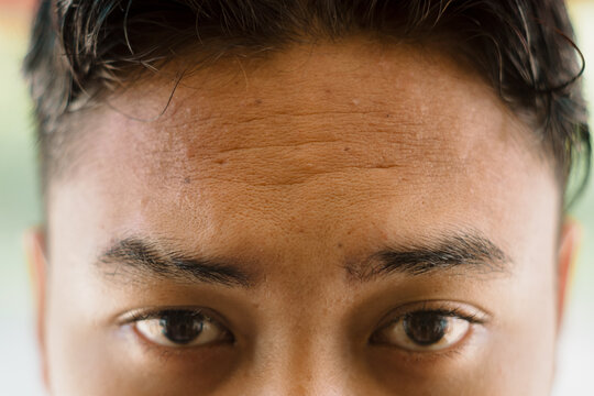 Half Face of a Young Asian Man