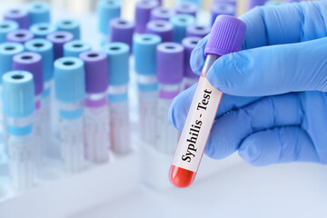 Doctor holding a test blood sample tube with Syphilis test on the background of medical test tubes...