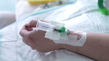 Hospital Nursing Care - Blood Sample Bottle Attached to Patient's Hand, Nurse Securing Straps