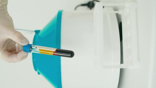 Vertical video showing a test tube being taken out of a centrifuge. In the device, the plasma separated from the blood. High quality 4k footage