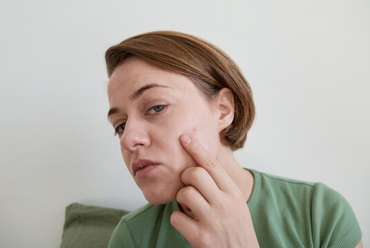 Skin Concern Examination