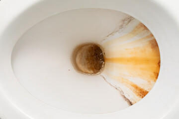 White Toilet Bowl With Brown Substance
