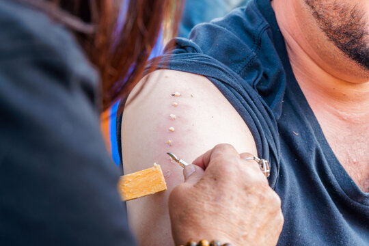 Kambo: Traces of the Ceremony