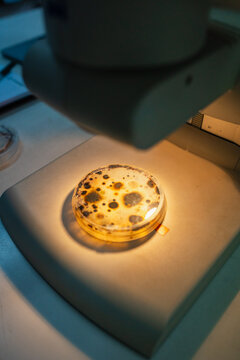 Fungi on Stereoscope. Microbial culture.