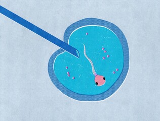 In vitro fertilization Concept 