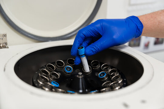 Lab technician's hand places a test tube in a centrifuge