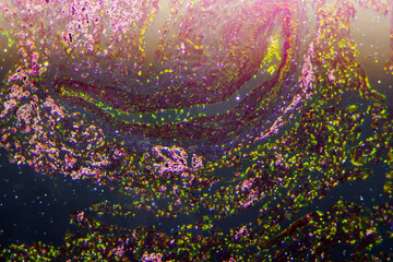 Diffuse pulmonary emphysema human cells