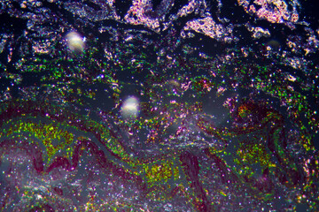 Diffuse pulmonary emphysema human cells