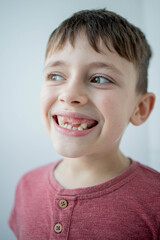 Kid losing a baby tooth and a new permanent tooth coming out