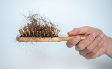 Someone holding a comb with hair loss after brushing hair. Hair loss it cause from family history,...