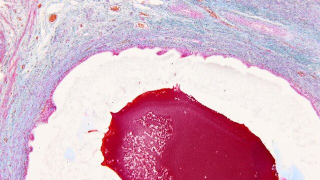 Pathology and Histology Tissue of Mammals under microscope.