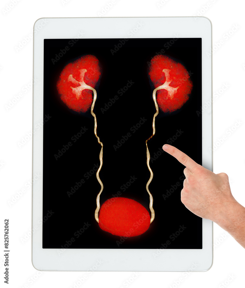 Poster the picture captures a hand indicating a 3d model of the urinary system on a tablet, emphasizing the