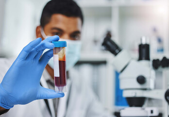 Man, worker and lab with blood sample for research, pathology and medical dna for healthcare. Face...