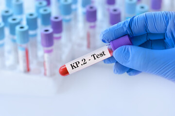 Doctor holding a test blood sample tube for the detection of the virus KP.2 on the background of...