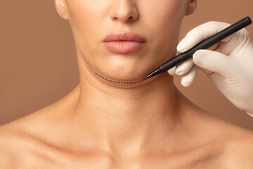 Double chin removal plastic surgery operation concept. Doctor surgeon hands drawing the cut line of female double chin, closeup, cropped
