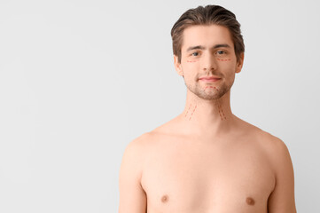 Fototapeta premium Young man with marked face on light background, closeup. Plastic surgery concept