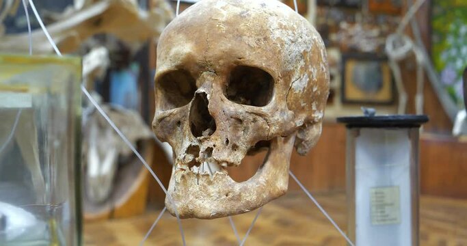 Human skull. Bones of human cranium