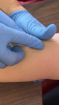 aboratory in clinic. Female lab assistant taking venous blood for test. Take blood from a vein for analysis