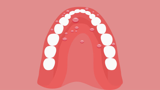 stomatitis emblem, flat color illustration
