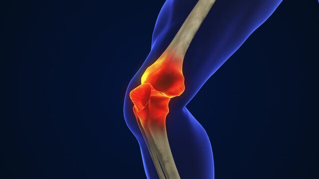 Anatomy Human Knee Joint Treatment, Osteoarthritis Injection
