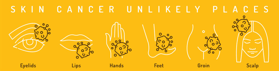 Skin cancer unlikely places. Landscape poster in outline style.