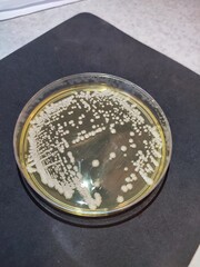 Yeast exhaustion streak on YPD medium to determine the purity of the culture. The yeast formed white, shiny, round colonies with a convex profile and a smooth edge