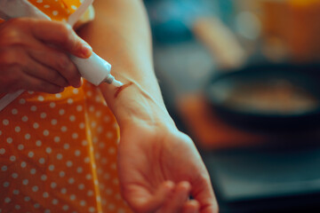 Home Cook Applying a Medical Cream on Burnt Skin. Woman suffering an injury while trying to cook...