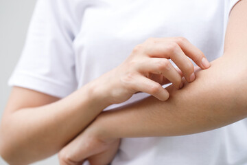 Health problems, woman has itchy hands