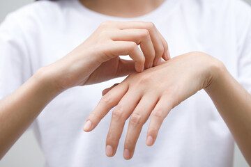 Health problems, woman has itchy hands