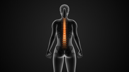 The medical condition of scoliosis of the spine