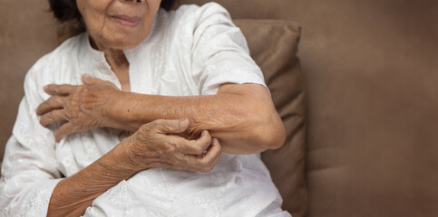 Elderly woman itchy and scratching arm because dry skin.