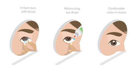 3D Isometric Flat  Illustration of Moisturizing Eye Drops, Using of Artificial Tears
