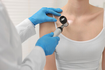 Obraz premium Dermatologist with dermatoscope examining patient in clinic, closeup
