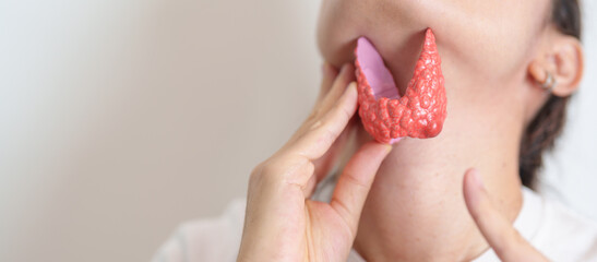 Woman holding human Thyroid anatomy model with her Neck. Hyperthyroidism, Hypothyroidism, Hashimoto...