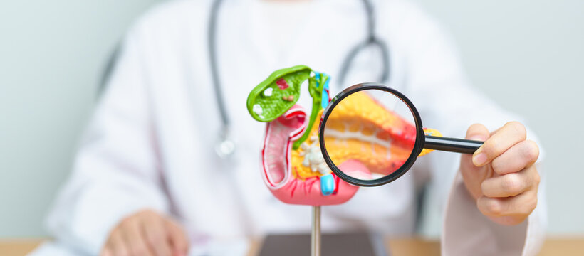Doctor with human Pancreatitis anatomy model with Pancreas, Gallbladder, Bile Duct, Duodenum, Small intestine and magnifying glass. Pancreatic cancer, acute pancreatitis and Digestive system