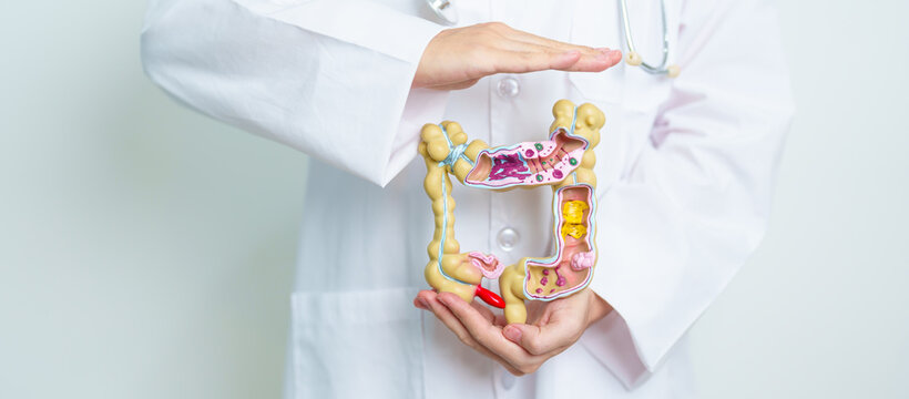 Doctor with human Colon anatomy model. Colonic disease, Large Intestine, Colorectal cancer, Ulcerative colitis, Diverticulitis, Irritable bowel syndrome, Digestive system and Health concept