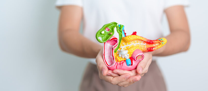 Woman holding human Pancreatitis anatomy model with Pancreas, Gallbladder, Bile Duct, Duodenum, Small intestine. Pancreatic cancer, Acute and Chronic pancreatitis,  Digestive system and Health concept