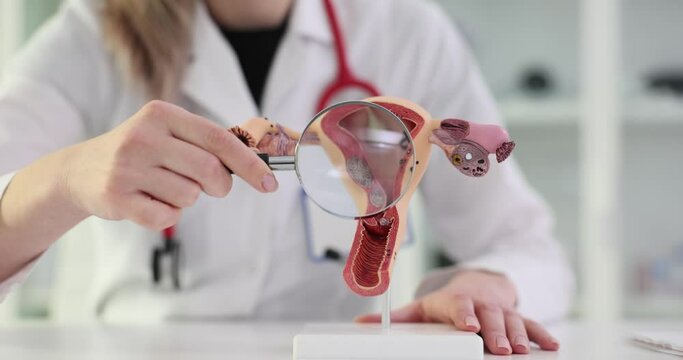 Doctor with anatomy model of the uterus and ovaries and a magnifying glass