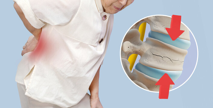 Back pain and spinal anatomy 3d illustration of elderly women_spinal compression fracture