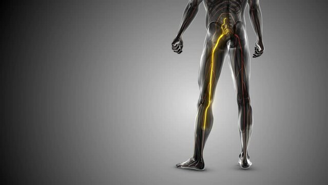 Sciatica pain from waist to leg