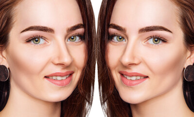 Young woman before and after chin correction. Over white background.