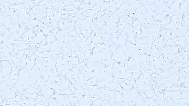 live culture of Lactobacillus acidophilus under the microscope (x400 magnification) - probiotics, dairy products and fermented foods concept