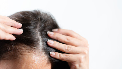 woman have hair loss problem